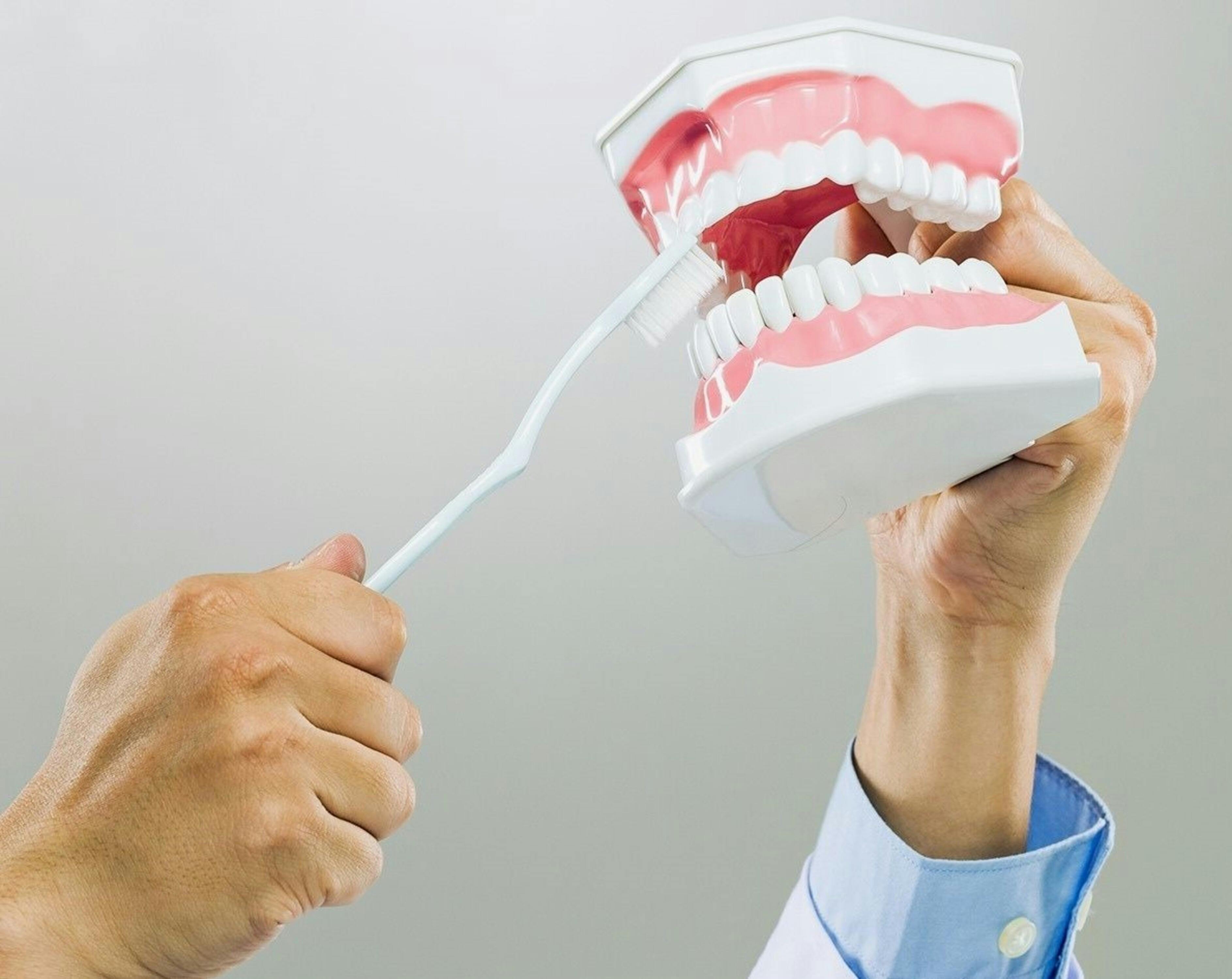 dents